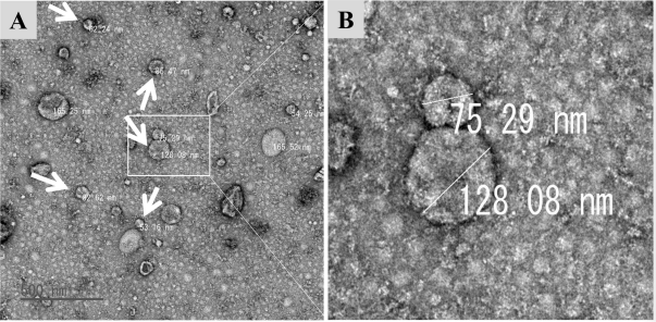 Exosome từ tế bào gốc mô mỡ cải thiện tình trạng lão hóa da