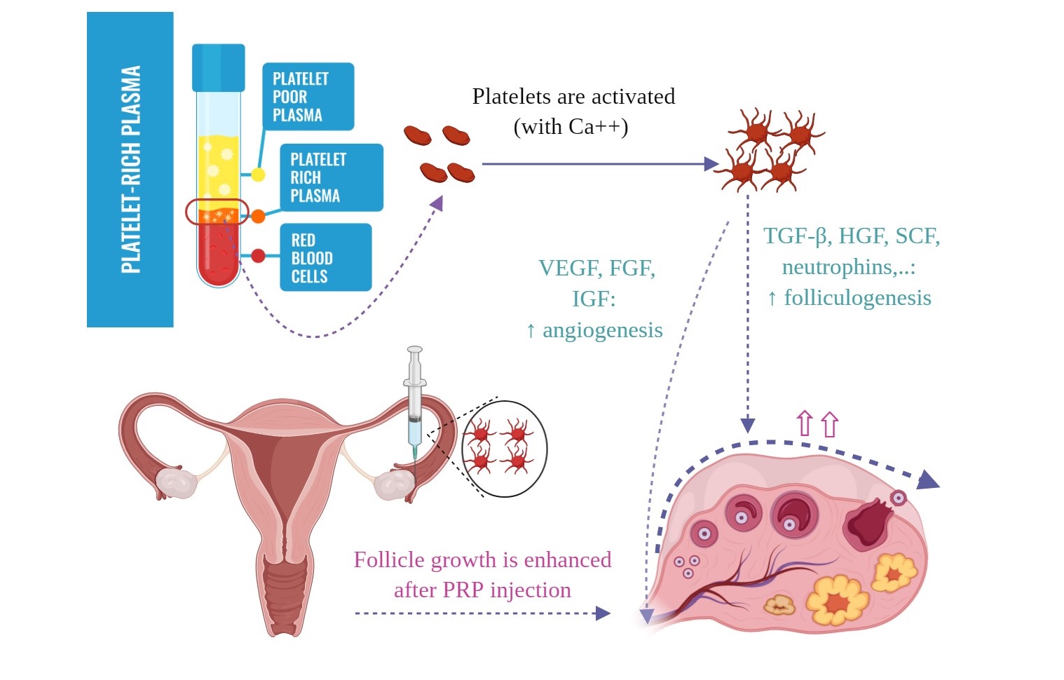 Tiêm PRP: Hướng đi mới trong IVF