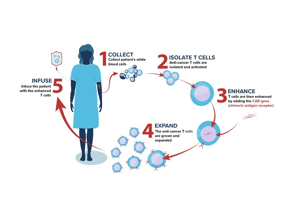 CAR-T: Liệu pháp tế bào T thụ thể kháng nguyên khảm